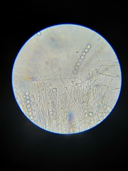 Pulvinula archeri