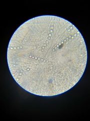 Pulvinula archeri