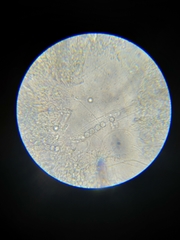 Pulvinula archeri