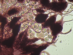 Cribraria microcarpa