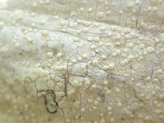 Pertusaria theochroa