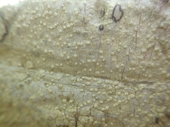 Pertusaria theochroa