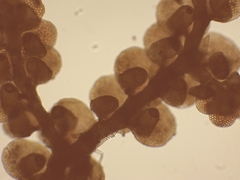 Frullania microphylla