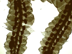 Frullania teneriffae