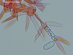 Hypomyces polyporinus