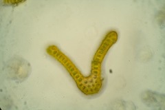 Racomitrium sudeticum
