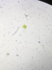 Glaucophyta
