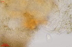 Odontotrema