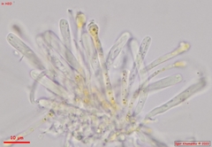 Orbilia xanthoguttulata