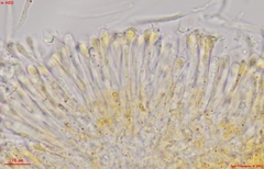 Orbilia xanthoguttulata