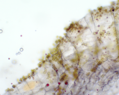 Colacium vesiculosum