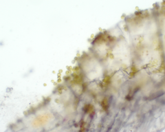 Colacium vesiculosum