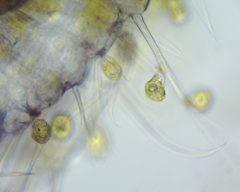 Colacium vesiculosum