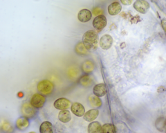 Colacium vesiculosum