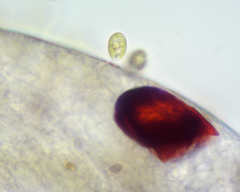 Colacium vesiculosum