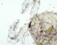 Colacium vesiculosum