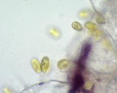 Colacium vesiculosum