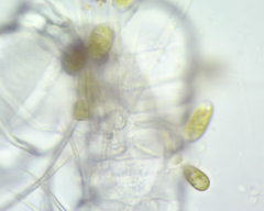 Colacium vesiculosum