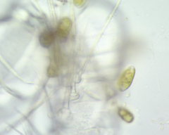 Colacium vesiculosum