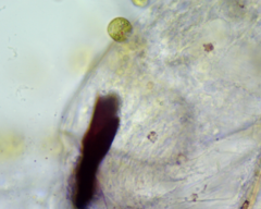 Colacium vesiculosum