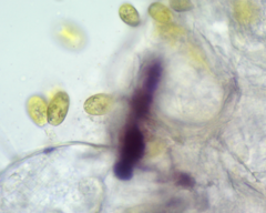 Colacium vesiculosum