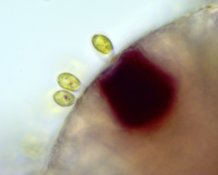 Colacium vesiculosum