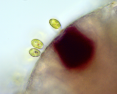 Colacium vesiculosum