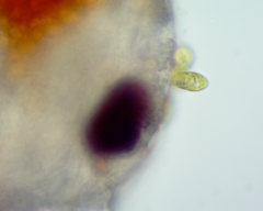 Colacium vesiculosum