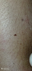 Parasitiformes