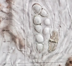 Rhizocarpon infernulum