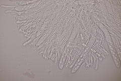 Spilopodia nervisequa