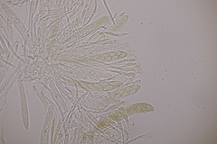 Spilopodia nervisequa