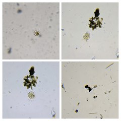 Strobilidium caudatum