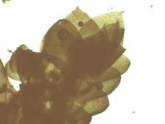 Frullania teneriffae