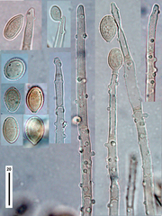 Botryobasidium conspersum