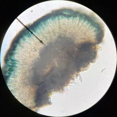 Scoliciosporum umbrinum