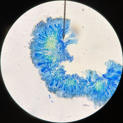 Scoliciosporum umbrinum