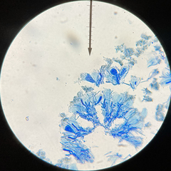 Scoliciosporum umbrinum
