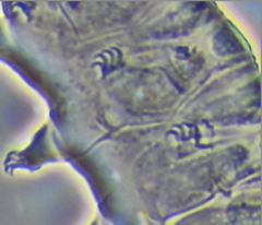 Echiniscidae