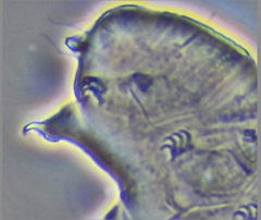 Echiniscidae