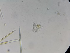 Strobilidium caudatum
