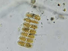 Denticula