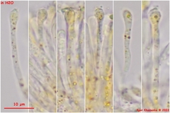 Orbilia xanthoguttulata