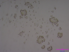 Coelosphaerium