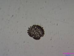 Coelosphaerium