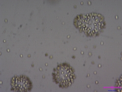 Coelosphaerium
