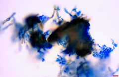 Microsphaeropsis ulmicola