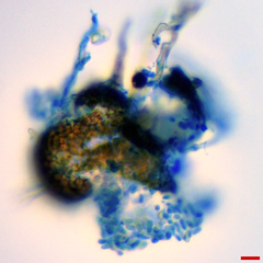 Microsphaeropsis ulmicola