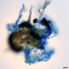 Microsphaeropsis ulmicola