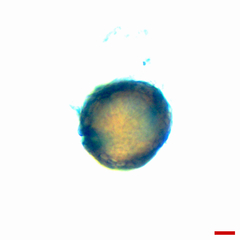 Microsphaeropsis ulmicola